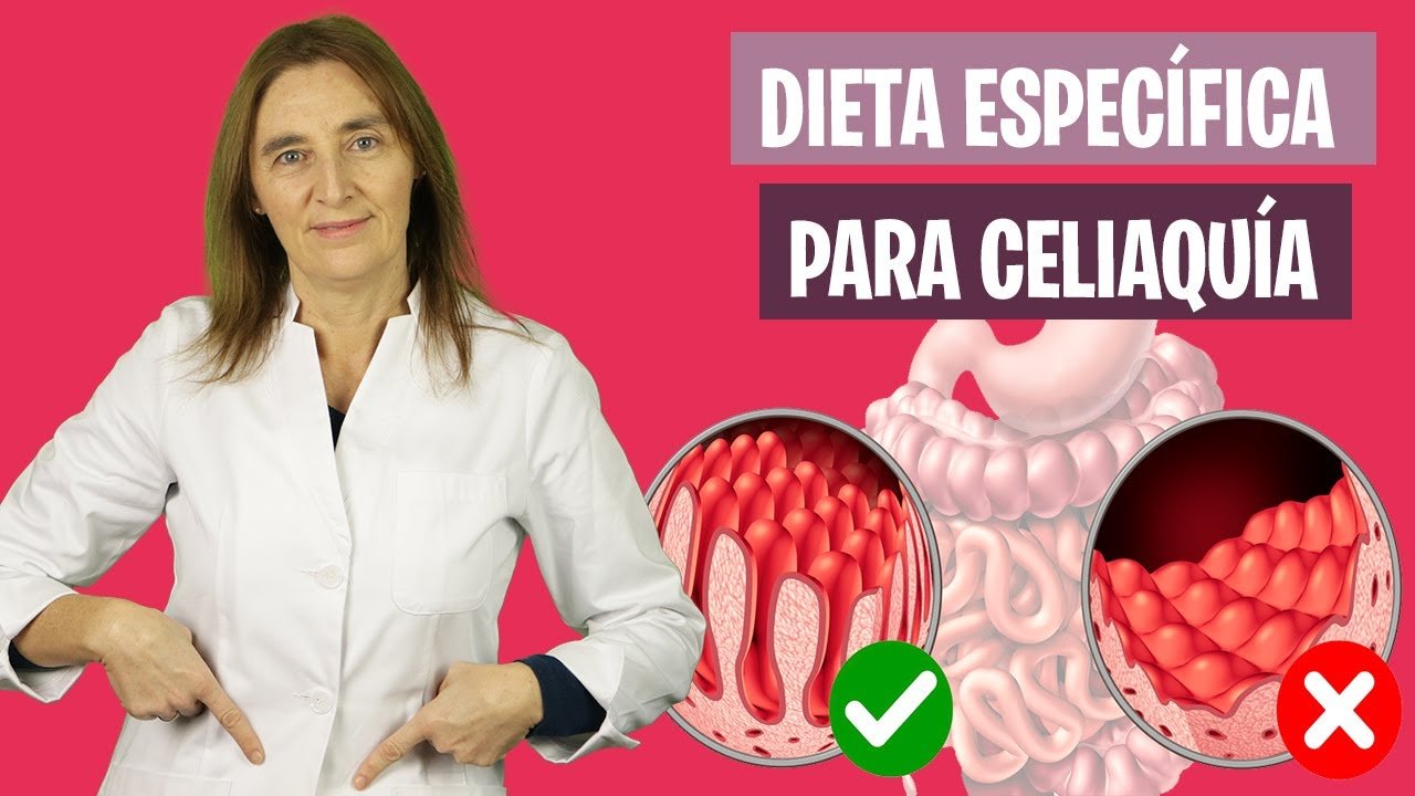 🧀Queso sin Gluten para Alérgicos al Gluten: ¡Opciones para Disfrutar!